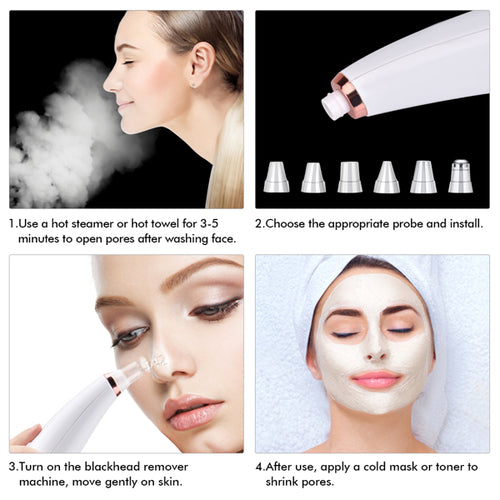 Aspirateur Facial Anti-Points Noirs — Nettoyage en Profondeur 5-en-1